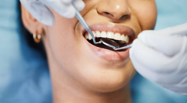 Best Emergency Wisdom Teeth Removal in Lannon, WI